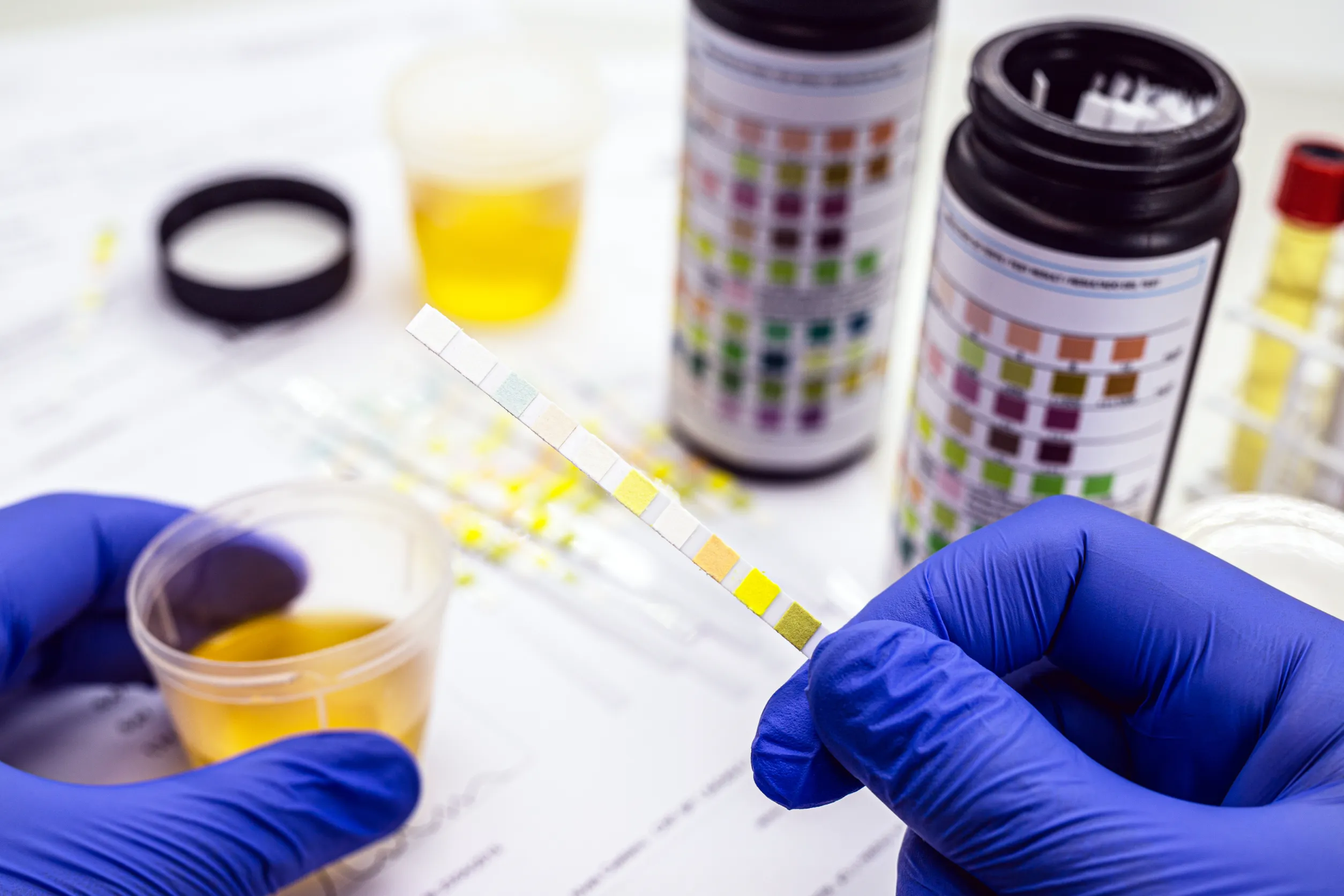 Drug Testing